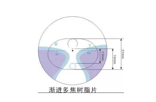 美麗島多焦鏡適合的人群，需要注意的事項(xiàng)