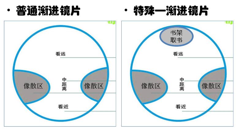 漸進(jìn)多焦鏡的原理與應(yīng)用，3個光區(qū)，看遠(yuǎn)近只需一副